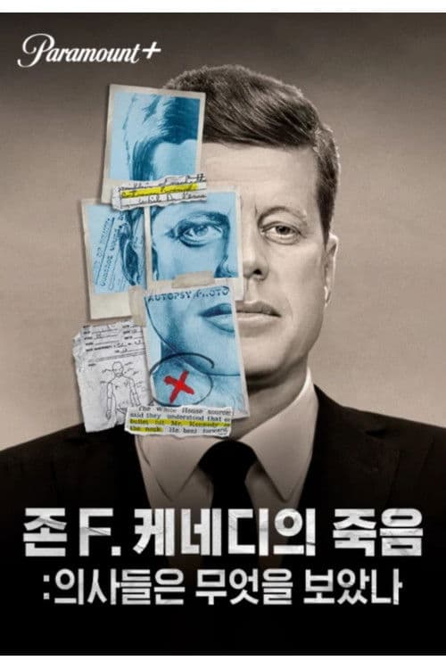 존. F 케네디의 죽음: 의사들은 무엇을 보았나